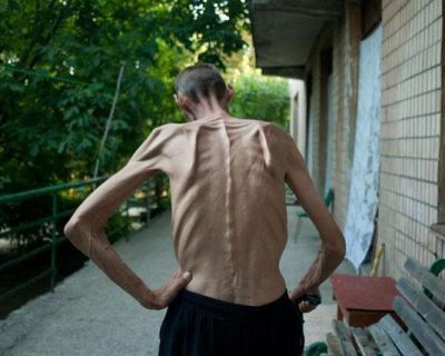 Майдан опасен для здоровья - будьте осторожны