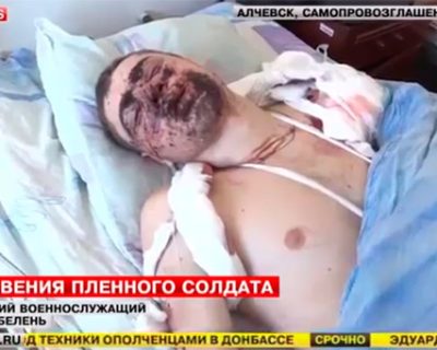 Раненый боец ВСУ рассказал, как его заставляли воевать