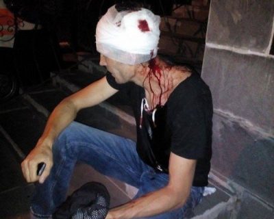 Под Киевом избивают сбежавших из Крыма проукраинских "активистов"