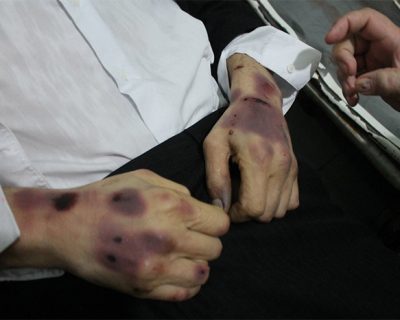 Пытки в застенках одесского Гестапо дошли до ООН